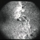 peripheral retinal nonperfusion, capillary abnormalities, leaking retinal microaneurysms, and blocked fluorescence